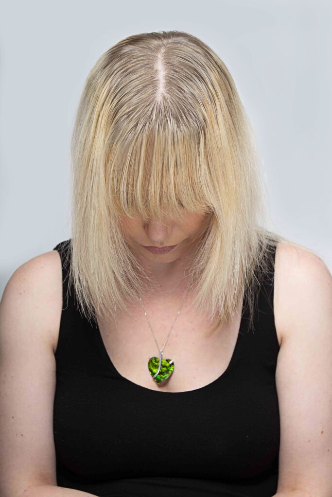 Before photo. The transformative value of hair pieces and toppers. Beech Grove Wig Boutique.